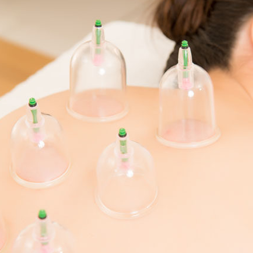 Cupping